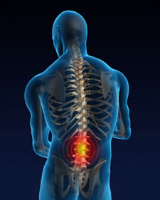 back-problems