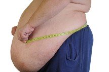 huge protruding stomach